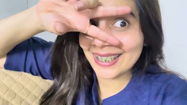 Ceramic braces cost/timeline/ Pain full update #viral #trending #dentalcare #teeth #dentist #youtube