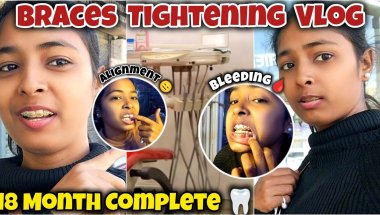 🦷😁18 Month Braces Tightening Day Vlog || Bleeding, Pain, Confidence 🥹 Miss Archu Vlogs #trending