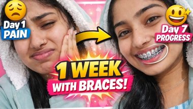 Day 7 Braces Journey | 1 Week with Braces 😬 Pain, Progress & Real Experience ✨