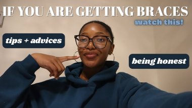 BRACES ADVICES/TALK |BEING HONEST, TIPS, COLORS & PAIN