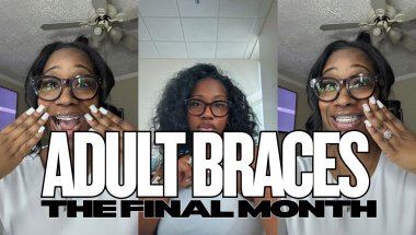 Adult Braces FAQ + My FINAL Month With Braces 🤭 What No One Tells You!