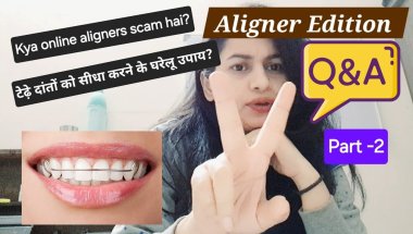 Aligners Q n A Part 2 🤐| Question and Answer |#aligners #braces #dentalcare #smilemakeover #teeth