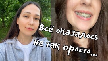 Я долго стеснялась своей улыбки. Мой путь к брекетам (эмоциональные качели)