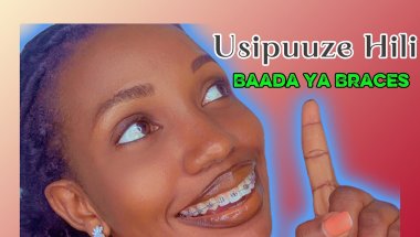 Siri Muhimu baada ya Braces