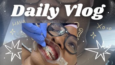 😂 BRACES, BEWARE! Alura's Journey to a Perfect Smile Takes a WILD Turn! 🤯#bracebracelet #braces