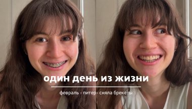 один день из жизни: сняла брекеты раньше срока
