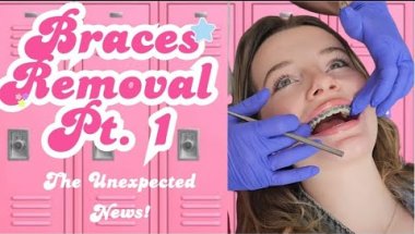 After 2 Years in Braces… They Couldn’t Remove All of Them 😳 | Mollie (Part 1)