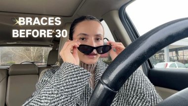 BRACES before 30! 😲🙆‍♀️ | SANDRA BUICA