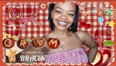 [TYLOR'S DIGITAL DIARY] LET'S GO CHANGE MY BRACES COLOUR!!
