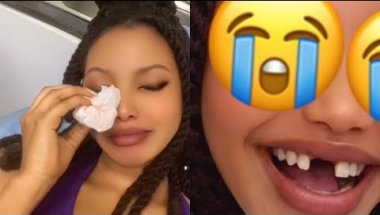IBYO WATEGANYA NYUMA YOGUKURAMO BRACES🙈😭😭🫢BIRABABAJE😭😭