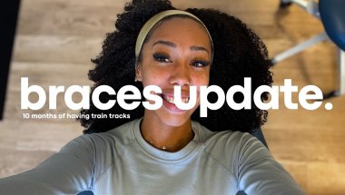 10 MONTH BRACES UPDATE 🦷✨ | Adult Braces Journey + Before & After Progress