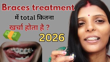 Braces cost in India | braces cost 2026 | type of braces #bracescost #braces #bracesupdate
