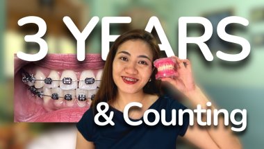 January 2026 Braces Updates | Wires |Treatment Plan