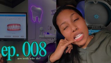 ep.  008 | new teeth, who dis? ft. Invisalign