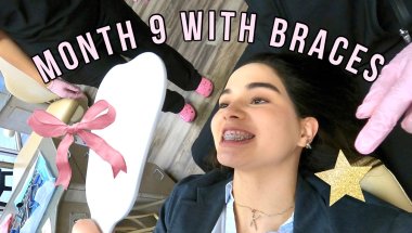 Braces Update Nine 🦷 (Completing nine months with braces)