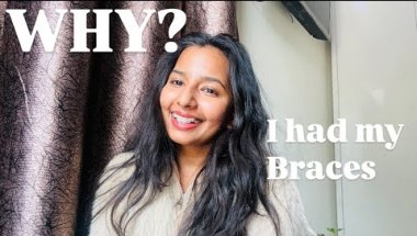 Why i had my braces | #braces #bracesjourney