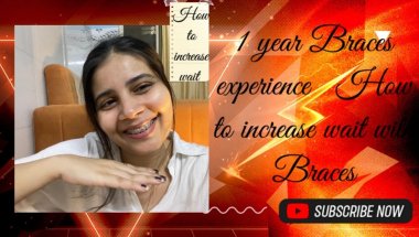 My 12months 2day braces journey ,how to increase wait with Braces🦷#viral #dentist #trending #youtube