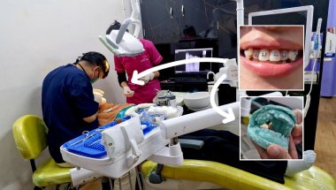 I Finally Got Braces… Here’s Everything They Did | Part 1 l Braces Vlog 2026 l