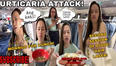 URTICARIA ATTACK! SECOND SESSION KO NA! TINGIN LANG SA H&M! SARAP NG MONNGO! Abengvlog #subscribe