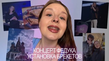 КОНЦЕРТ ФЕДУКА | Москва, апрель 2025 | установка брекетов на низ