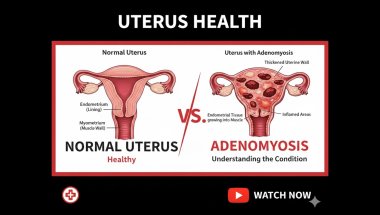 PMDD, Perimenopause & Adenomyosis: Why I’m Burnt Out and Stepping Back