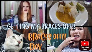 GETTING MY BRACES OFF!! || GETTING FIXED RETAINERS || COME WITH ME FOR  GETTING MY BRACES OFF