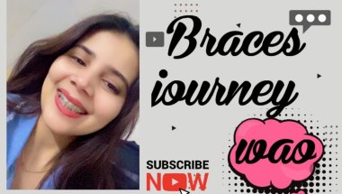 Braces cost in india ,braces me cavity kyu lagte hai#viral viral #trending #dentalcare #dentist #