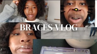 Debbie's World| Ep1- Braces Vlog🤸‍♀️