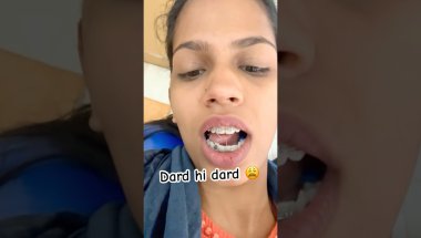 Mehndi artist ke kam😂| orthodontic braces😬 #orthodontic #dentalclinic #mehndiartist #mehndidesign