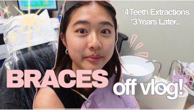 GETTING MY BRACES OFF!! *after 3 years*