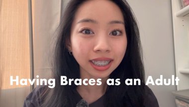 one year update on my adult braces! 🔗 teeth journey | surgery | pricing