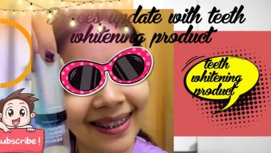 Braces journey with teeth whitening products/let see#viral #trending #dentalcare #teeth