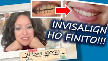 Ultimo giorno di Invisalign! 15 mesi totali