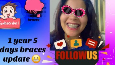 My 1 year 5 days braces journey #viral #trending #trending #dentist #dentist #youtube #toptrending