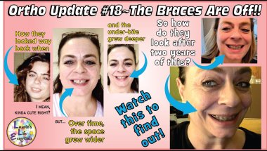 Ortho Update #18 ~ THE BRACES ARE OFF!!! :D