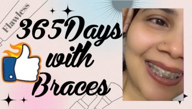 When you are getting braces you need to know about braces/Cost/timeline/pain/2026#viral #trending #