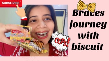 Braces journey with PARLE-G#viral #smiledesigndental #trending #youtube #teeth #dentalcare #dentist