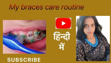 Daily Braces Cleaning Routine | How I keep My Braces And Teeth clean 🦷✨