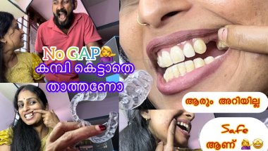 പൊന്തിച്ചയുണ്ടോ, വിടവുണ്ടോ/ solutions /Aligners/DentCare