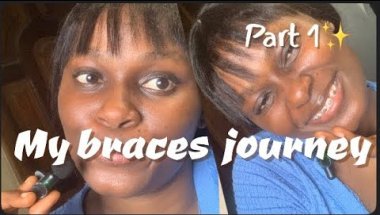 My braces  journey//orthodontist treatment