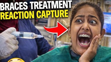 😱Reaction | Funny Prank During my Braces Treatment | #prank #reaction #funny #vlog