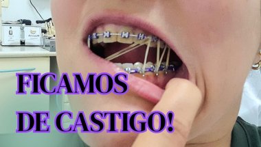 MANUTENÇÃO DO MEU APARELHO NO DENTE #dentista #aparelhoortodôntico
