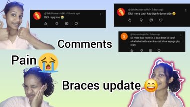 Braces update after tightening🥺with Q n#braces#bracesjourney#bracescomments#viral