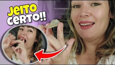 COMO COLOCAR APRELHO MOVEL NOS DENTES DE FORMA CORRETA!!!