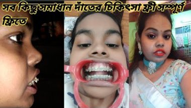 আজ হাসপাতালে যায়ার পর ডাক্তার কেনো বাড়ি পাঠিয়ে দিলো। সম্পূর্ণ ফ্রিতে দাঁতের চিকিৎসা|