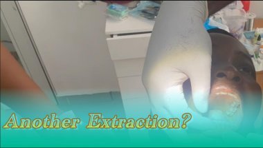 Back to My Braces Journey After Baby | Orthodontist Appointment Update