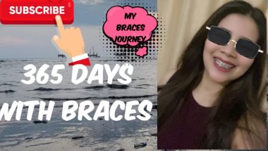 12 months 8 day braces journey #viral #trending #dentist #dentalcare #youtube #teeth