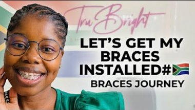‼️🇿🇦This is how BRACES are INSTALLED | Step by step installation process‼️