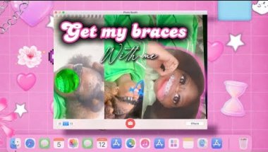 Braces vlog💞