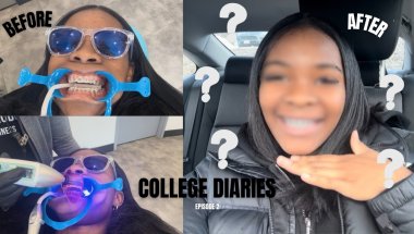 Come With Me To Get Braces Again | Life As Dri